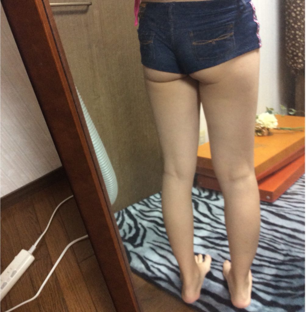 ビフォアー写真